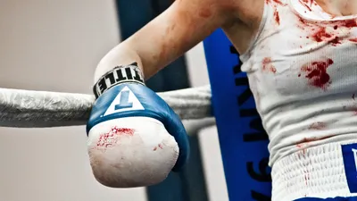 Vivid Close Wallpaper Abstract Wallpaper 4K 2560x1440 Hd, Pc, Desktop, Wallpaper, Showing, A, Close-up, Of, Bloodied, Boxing, Glove, Arm, Gray, White, Ultrawide, QHD